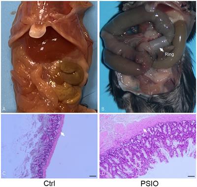 Alterations of gut microbiota in a mouse model with partial small intestinal obstruction